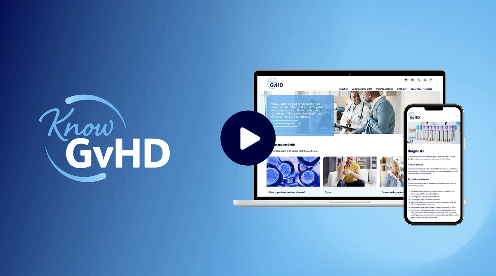 Know GvHD previewing on multiple devices